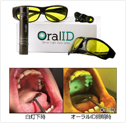 口腔内蛍光観察装置　Oral ID（オーラルアイディー）